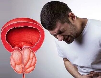 Symptoms of chronic prostatitis to men