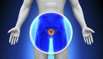 Treatment of prostatitis with medication