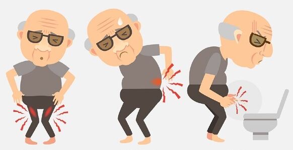 symptoms of prostatitis and its treatment with drugs